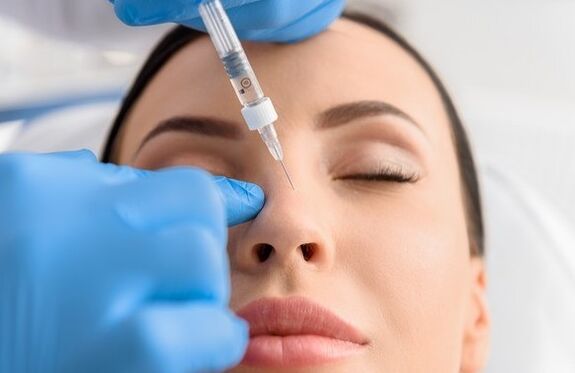 Metoda rinoplastiei non -logice