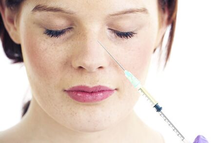 Rinoplastie nechirurgicala cu umpluturi